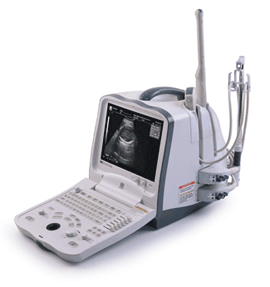 УЗИ Аппарат (Сканер) MINDRAY DP-6600