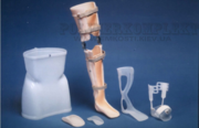Ортопедические пластики для протезов