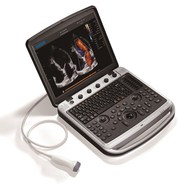 Новый аппарат УЗИ Chison SonoBook 9 с двумя датчиками